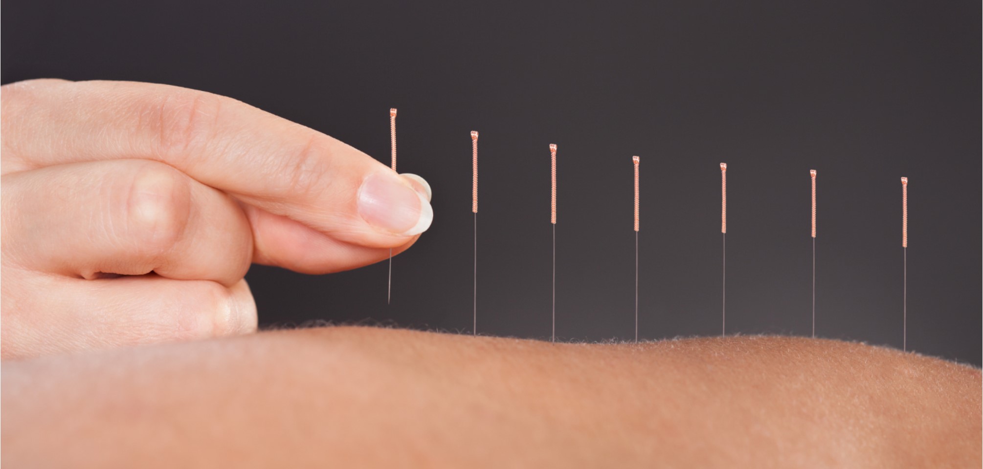Using Acupuncture for Fertility Treatment